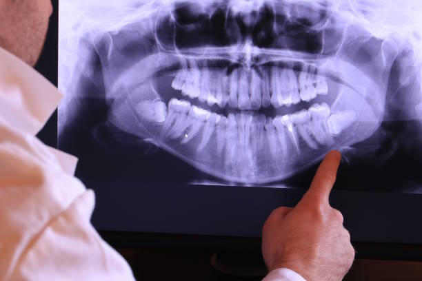 Best Emergency Tooth Extraction in Rapid City, MI