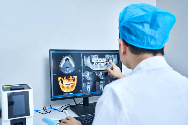 Best Emergency Gum Treatment in Rapid City, MI
